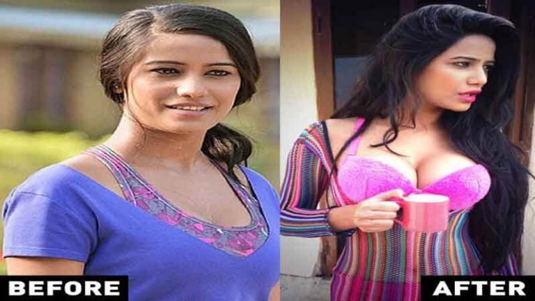 These TV Actresses Have Undergone Plastic Surgery