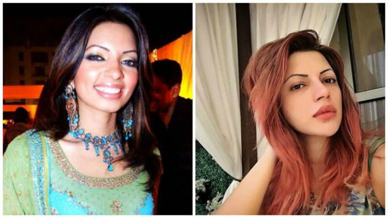 These TV Actresses Have Undergone Plastic Surgery